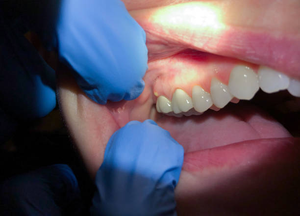 Best Pediatric Emergency Dentist in Three Rivers, CA